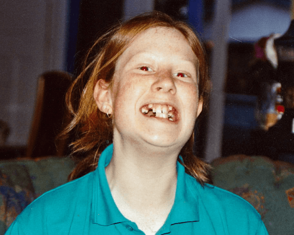 Dr Sally Woods before braces | McKeefry Dental